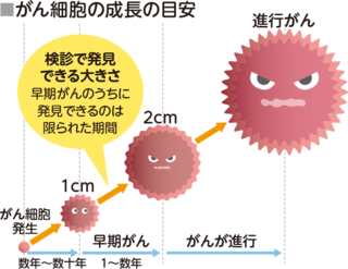 がん細胞の成長の目安。がん細胞が発生し数年～数十年で1㎝になり、1～数年で早期がんとなり、検診で発見できる大きさになる。早期がんのうちに発見できるのは限られた期間です。2cmからがんが進行していき、進行がんとなります。