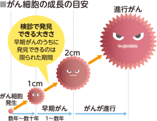 がん細胞の発生から検診で発見できる大きさになるまでは数年から数十年、早期がんのうちに発見できるのはそこから1年～数年の限られた期間です。