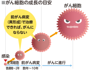 がん細胞の成長の目安 正常細胞が前がん病変(異形成)になるまで数週間から2年。それががん細胞になるまで数年から10年。この段階で治療できれば、がんになりません。