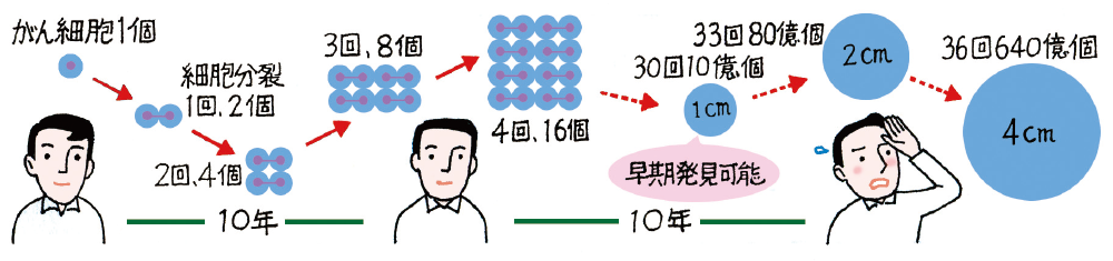 がん細胞1個から細胞分裂1回で2個、2回で4個、3回で8個になるまでに10年。細胞分裂を33回繰り返すと、80億個で2センチメートル。ここまでがさらに10年になります。