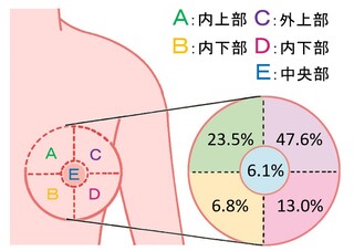乳がんの部位別発症割合。内側上部、23.5%。外側上部、47.6%。内側下部、6.8%。外側下部、13.0%。乳輪部、6.1%