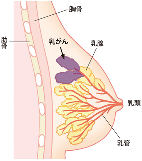 乳がん
