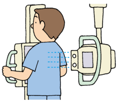 胸部X線検査 胸部X線検査